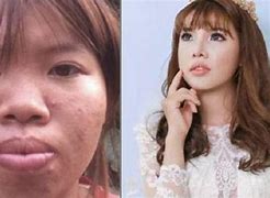 砸上百万整容的姑娘她现在怎样了?